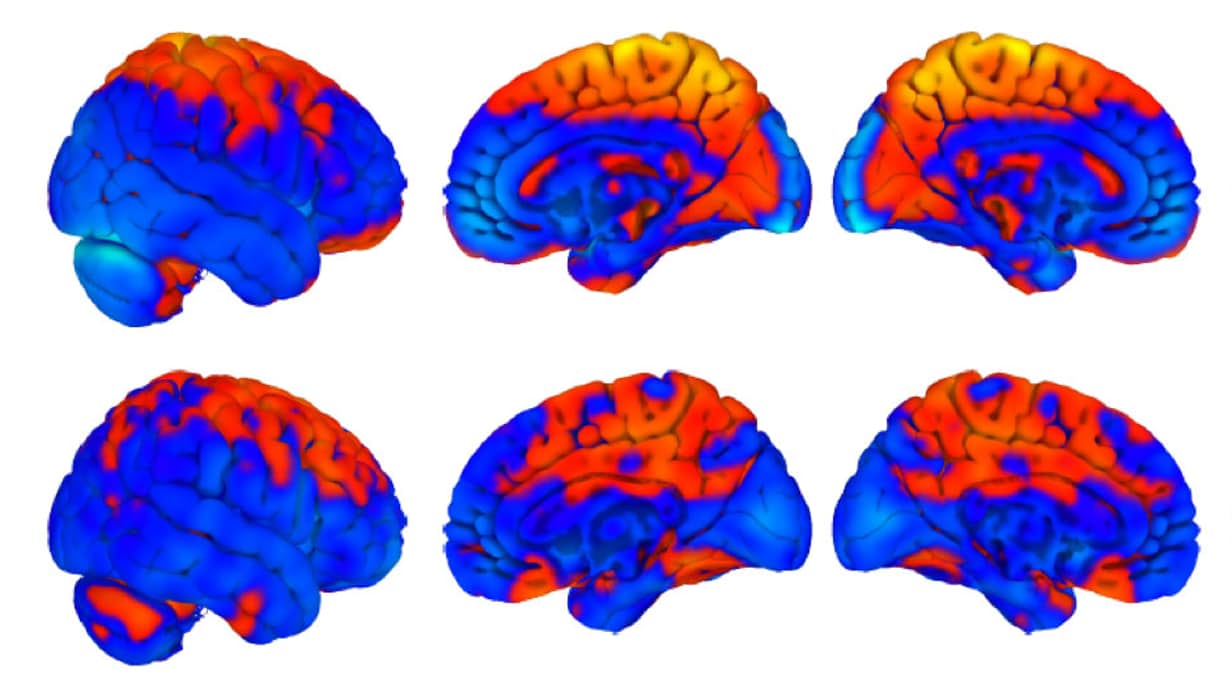 astrobaut-brain-changes-5.jpg